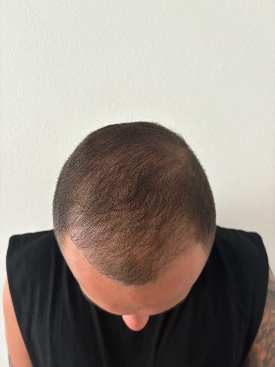 Before